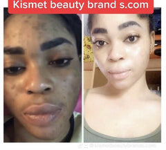 Hyprogel Body Tube Gel 1 oz / 30 g