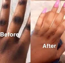 Hyprogel Body Tube Gel 1 oz / 30 g