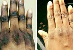 Hyprogel Body Tube Gel 1 oz / 30 g