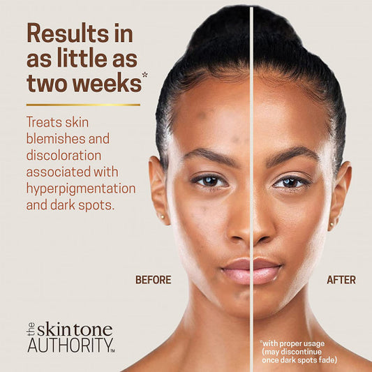 What causes dull skin