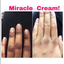 Hypprogel Tube Cream 1.5 oz / 40 g x10