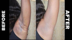 Carotone Dark Spot Corrector hyperpigmentation corrector carotone