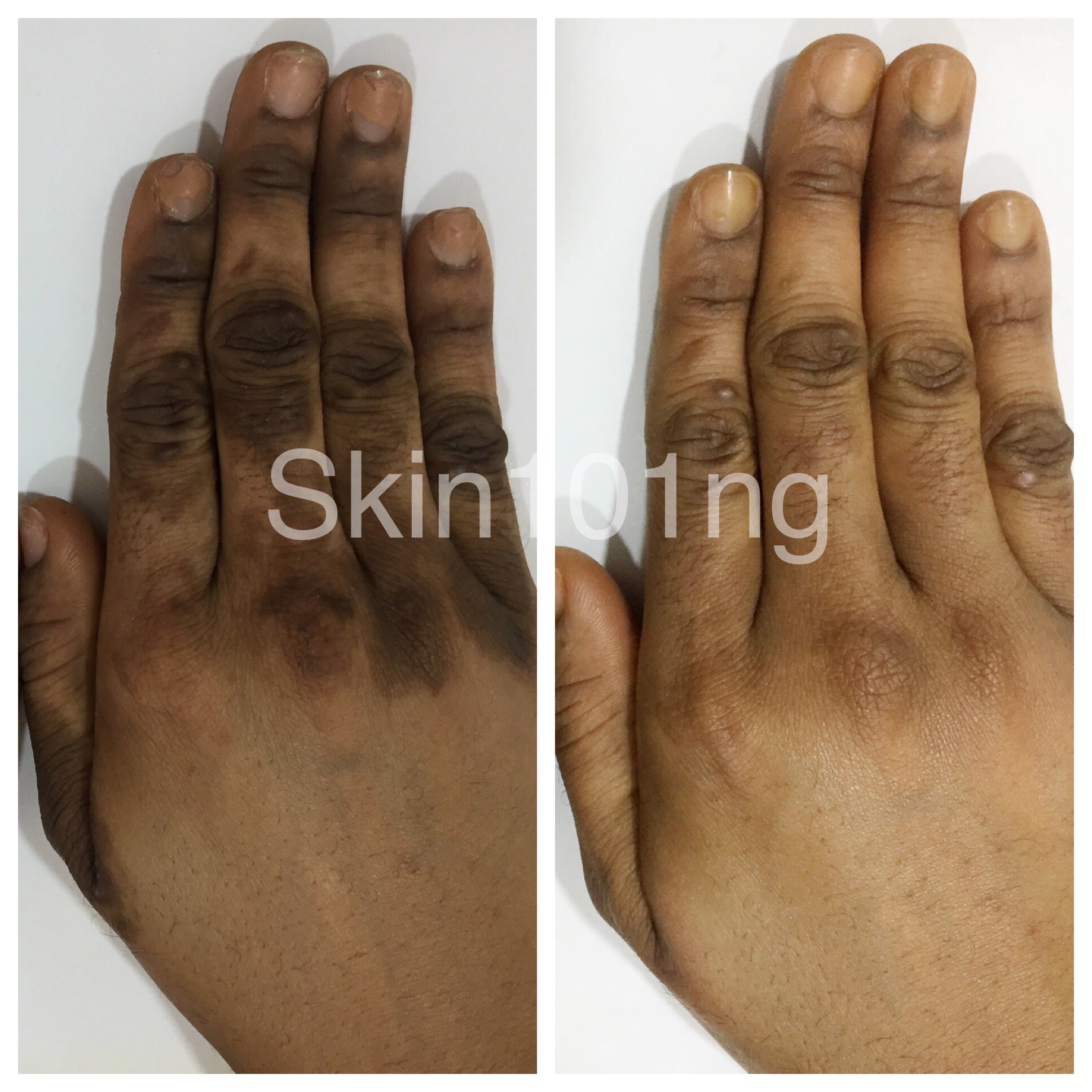 Coco Clear DSR Cream 30ml COCO Clear