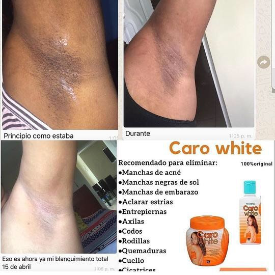Caro White Lightening Beauty Cream With Carrot Oil 300 ml Carowhite