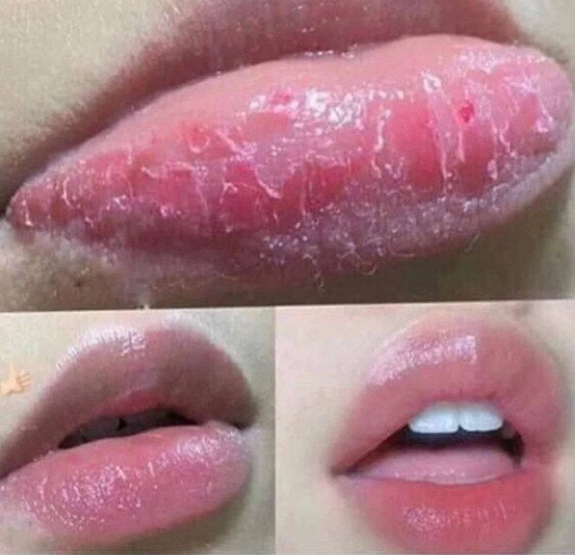 Pink Lips cream, Lightening Firming Rejuvenating Dark Lips & Stains Remover.