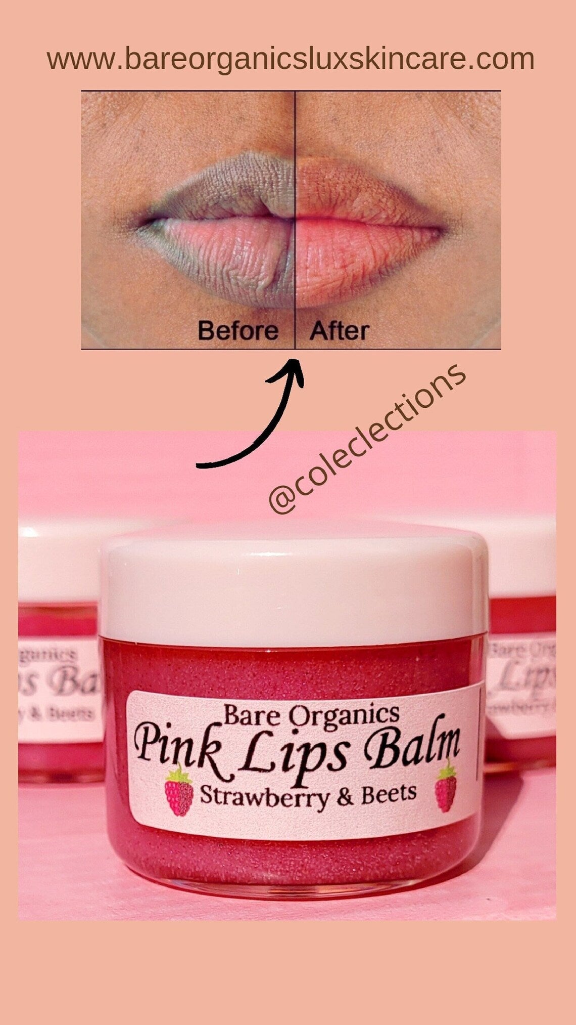 Pink Lips cream, Lightening Firming Rejuvenating Dark Lips & Stains Remover.