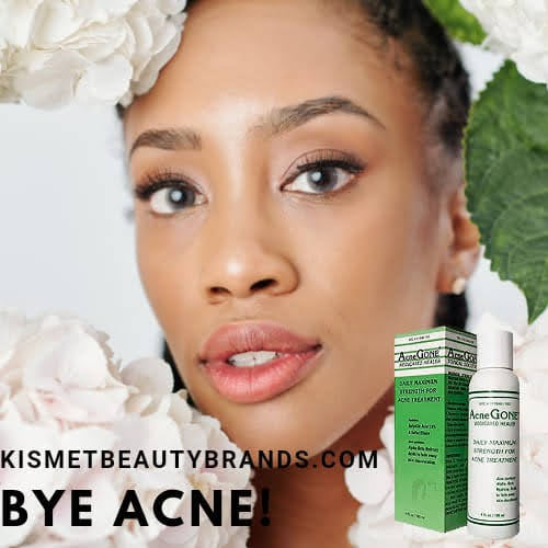 Acne gone medicated healer 4oz acne gone