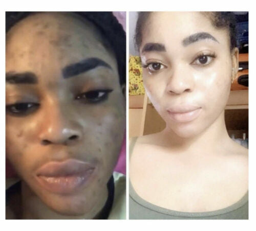Skin Light Skin Lightening Oil 3 oz / 90 ml