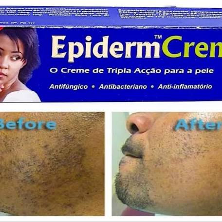 Epiderm Fast Action Crème 1oz/30g 3pcs Epiderm