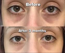Clear Essence LEMON Plus Vit-C Perfecting Under Eye Fade Serum 0.5oz / 15ml Clear Essance