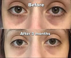 Clear Essence LEMON Plus Vit-C Perfecting Under Eye Fade Serum 0.5oz / 15ml Clear Essance